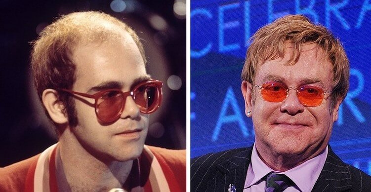Elton John and His Wig